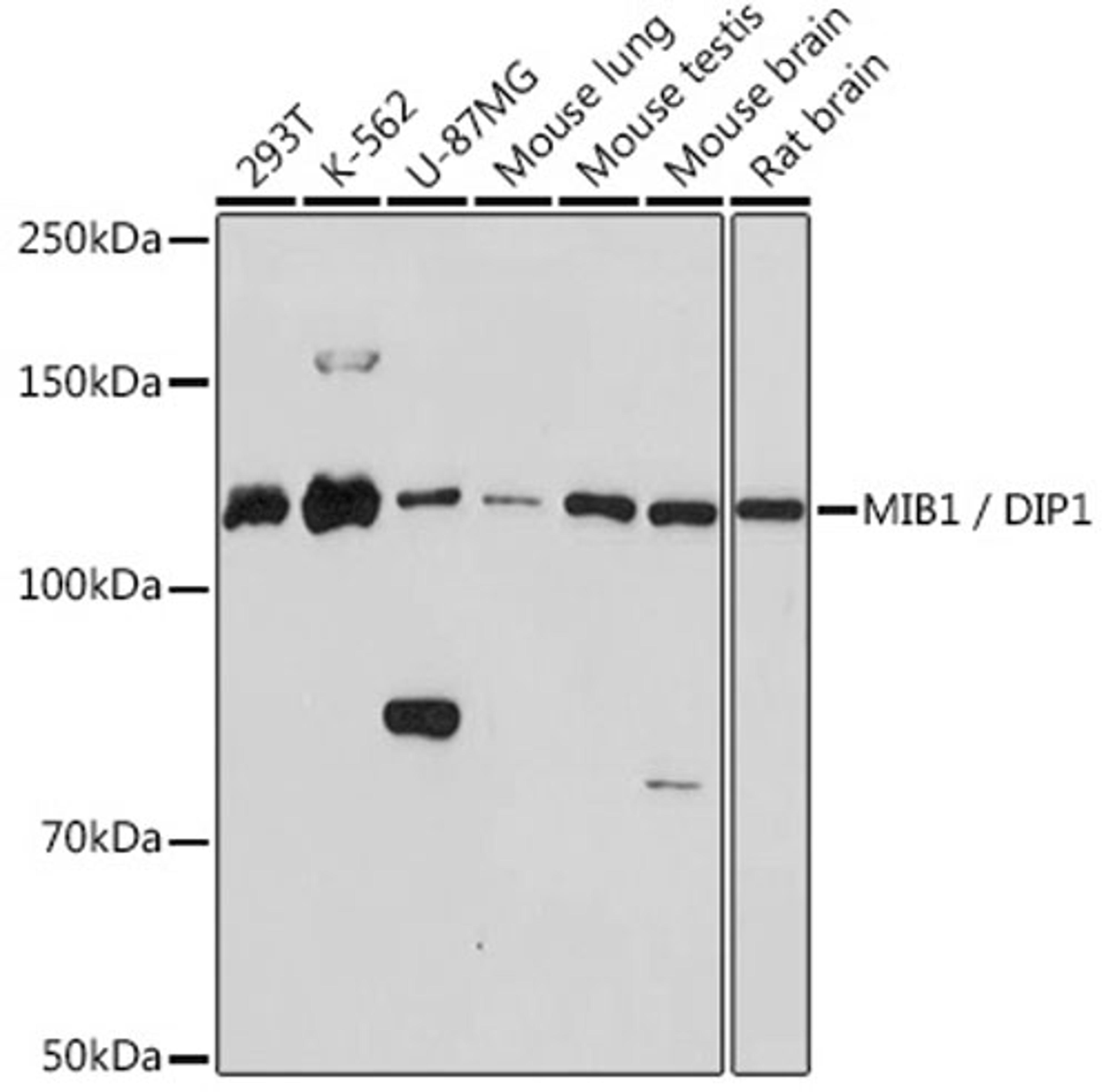 Western blot - MIB1 / DIP1 Rabbit mAb (A3371)