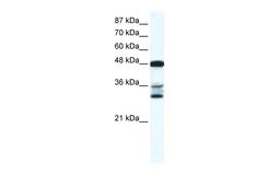 Antibody used in WB on Human HeLa at 0.2-1 ug/ml.