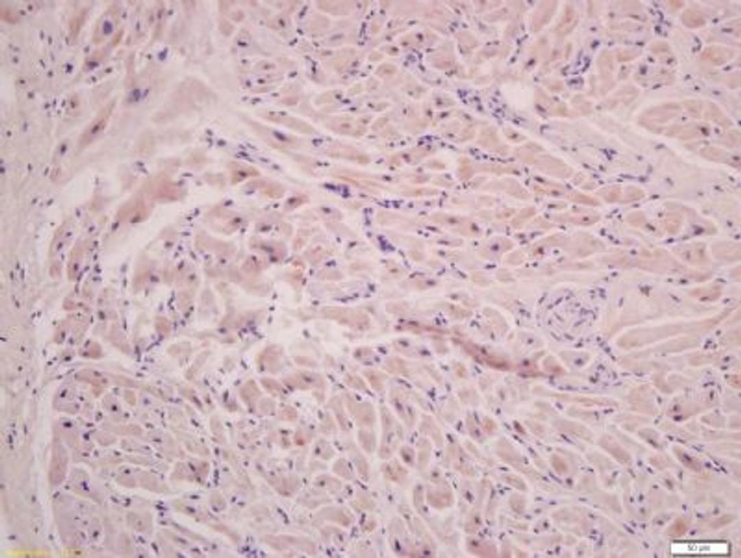 Immunohistochemical staining of rat cardiac muscle tissue using Filamin 2 antibody.