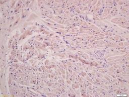 Immunohistochemical staining of rat cardiac muscle tissue using Filamin 2 antibody.