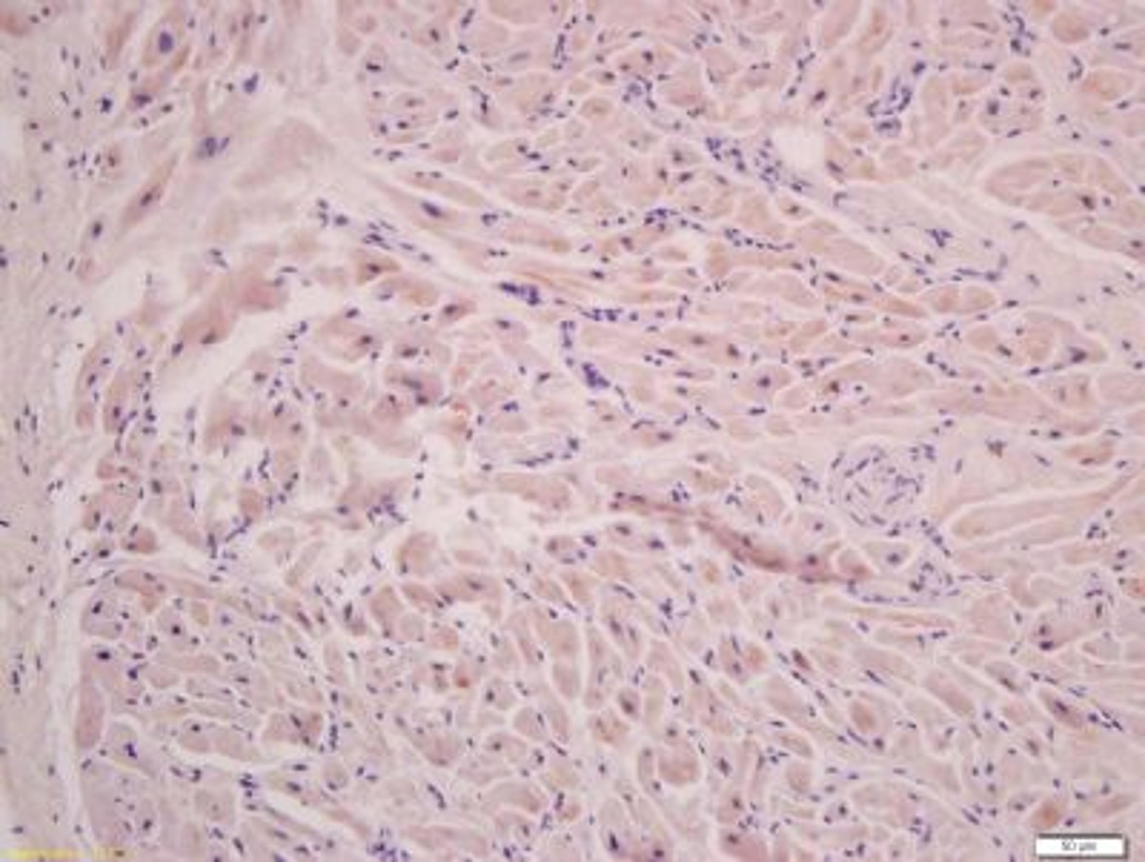 Immunohistochemical staining of rat cardiac muscle tissue using Filamin 2 antibody.