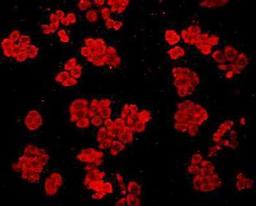 Immunofluorescent staining of HepG2 (red) Cells using GRP78 BiP antibody