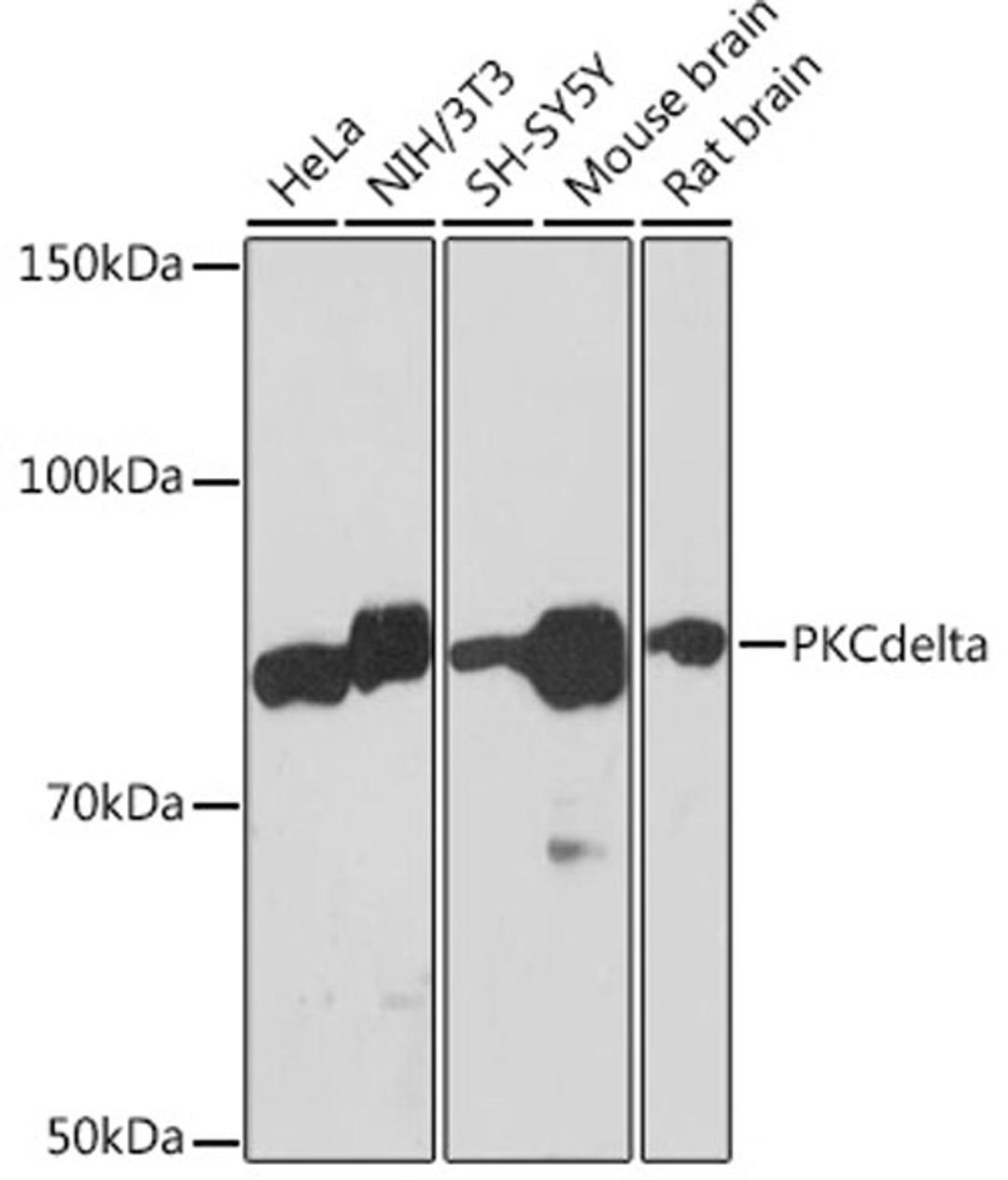 Western blot - PKCdelta Rabbit mAb (A7778)