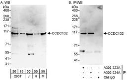 Detection of human and mouse CCDC132 by WB (h and m) and IP.