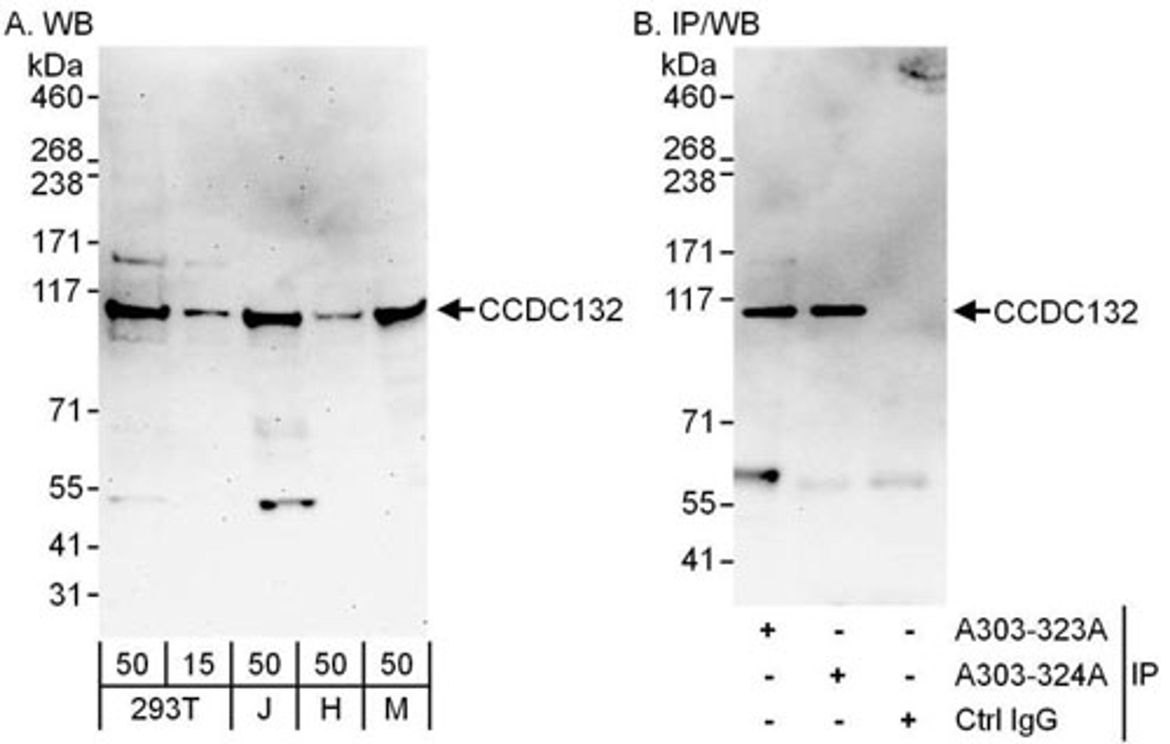 Detection of human and mouse CCDC132 by WB (h and m) and IP.