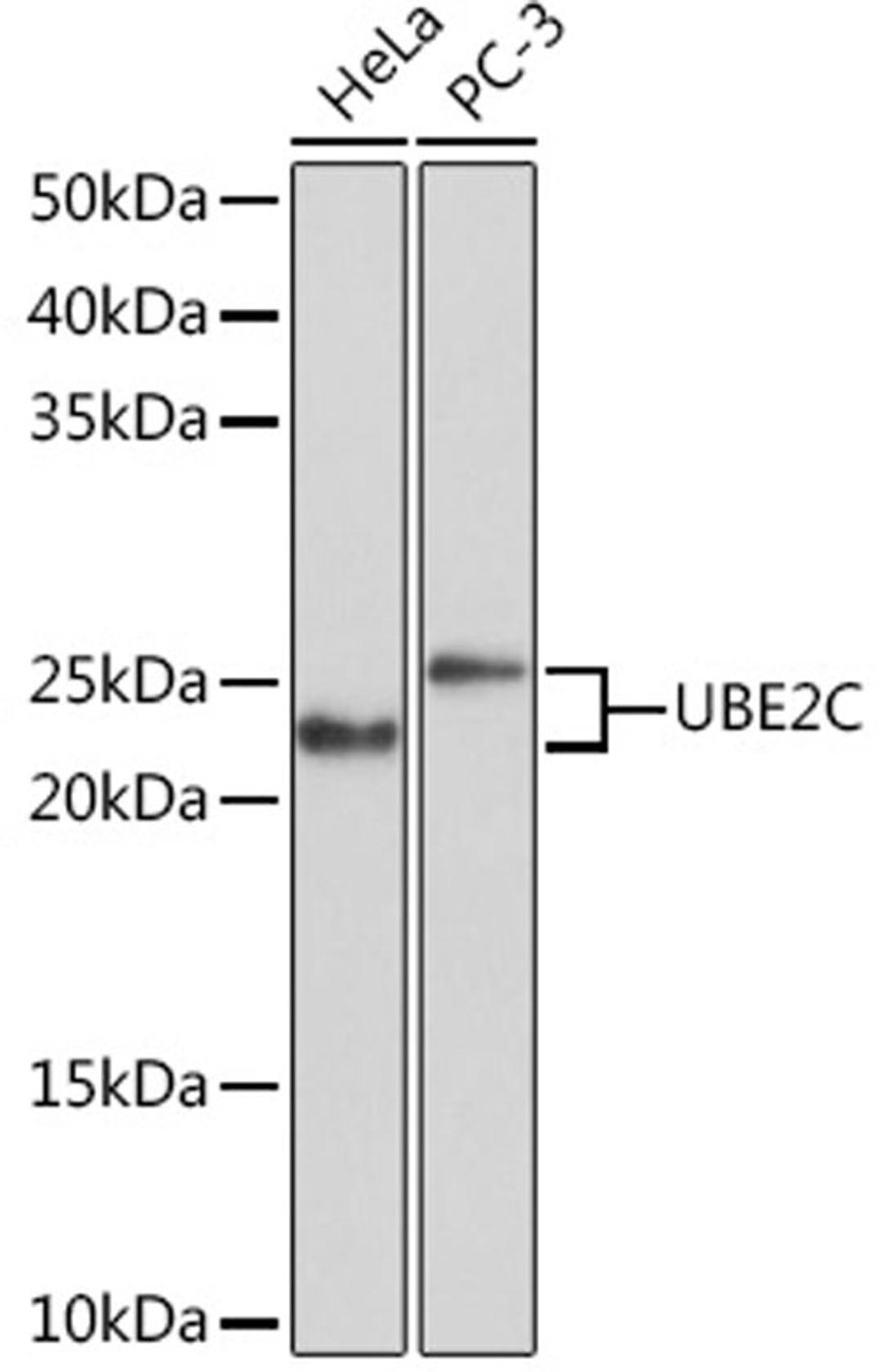 Western blot - UBE2C Rabbit mAb (A5206)