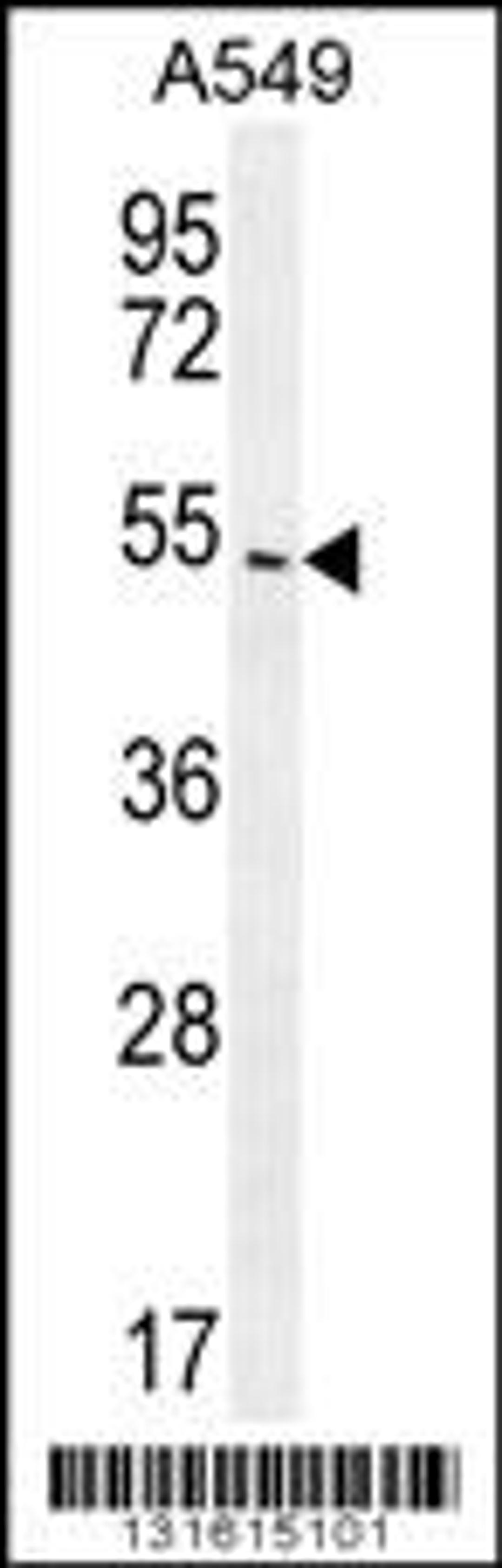 Western blot analysis in A549 cell line lysates (35ug/lane).