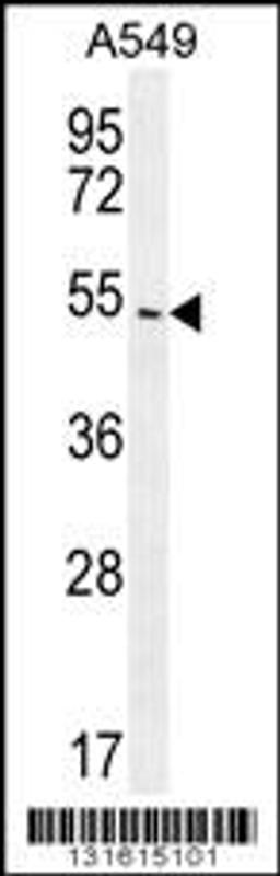 Western blot analysis in A549 cell line lysates (35ug/lane).