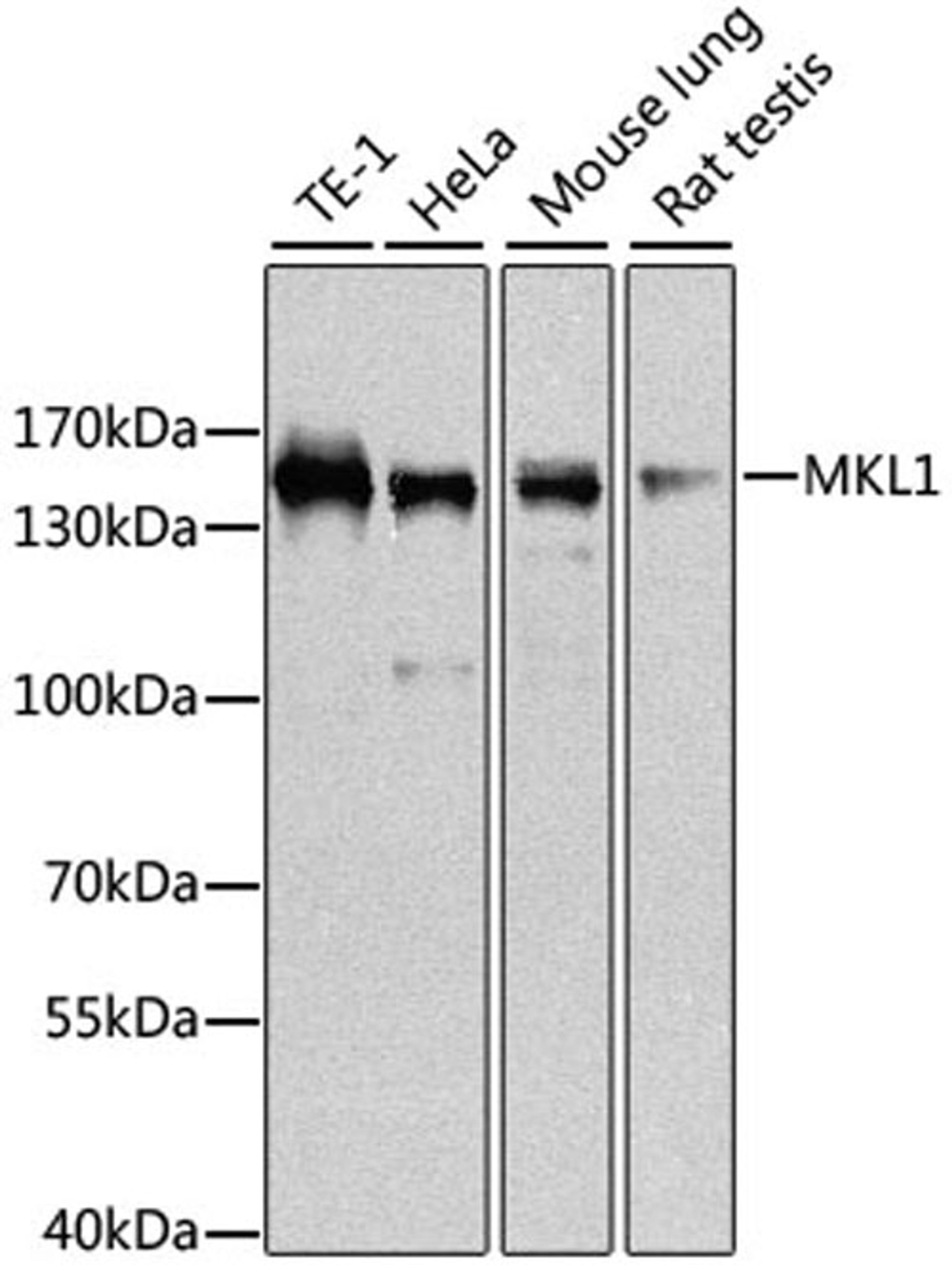 Western blot - MKL1 antibody (A8504)