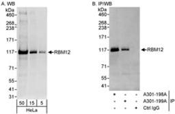 Detection of human RBM12 by western blot and immunoprecipitation.