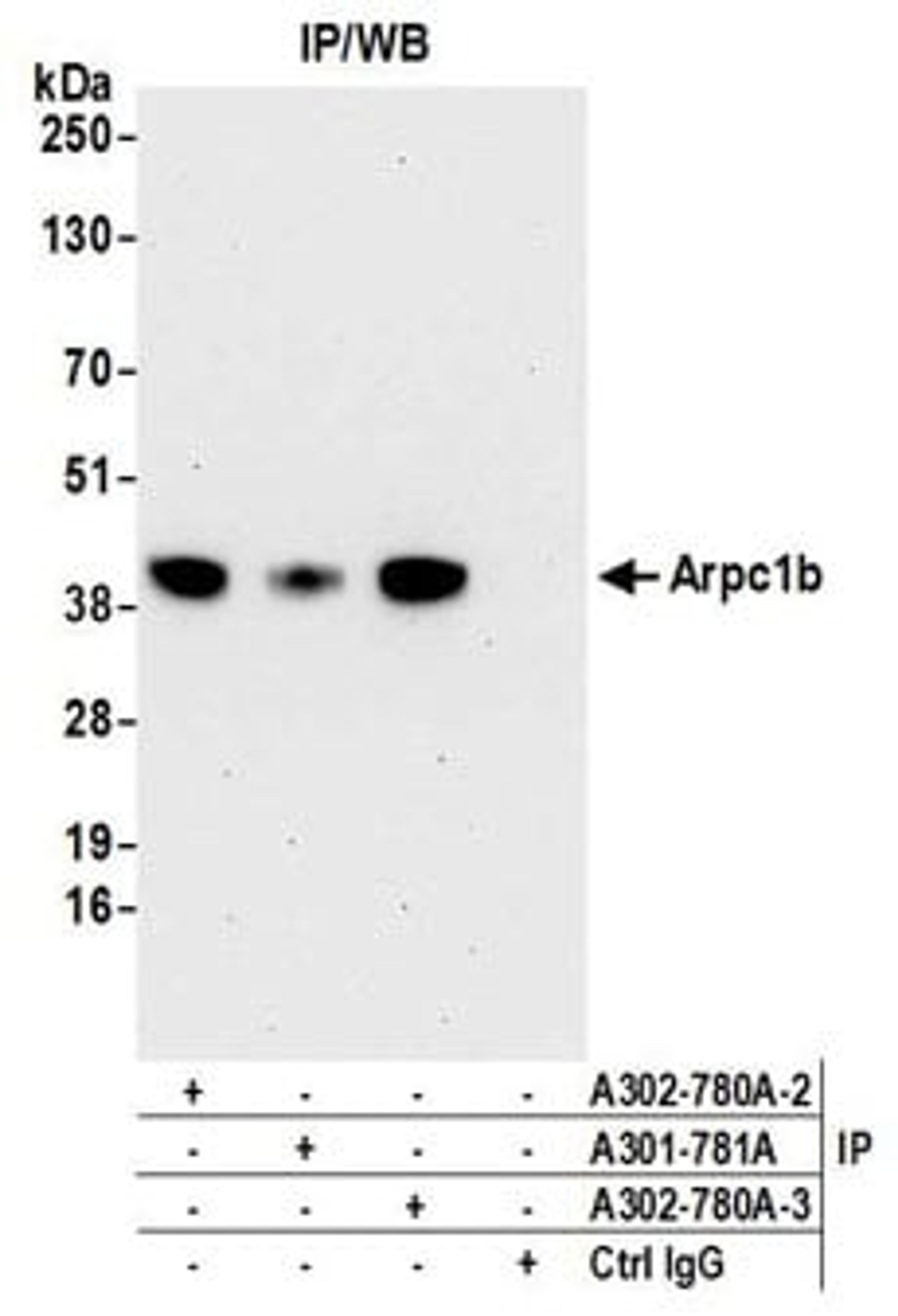 Detection of human Arpc1b by western blot of immunoprecipitates.