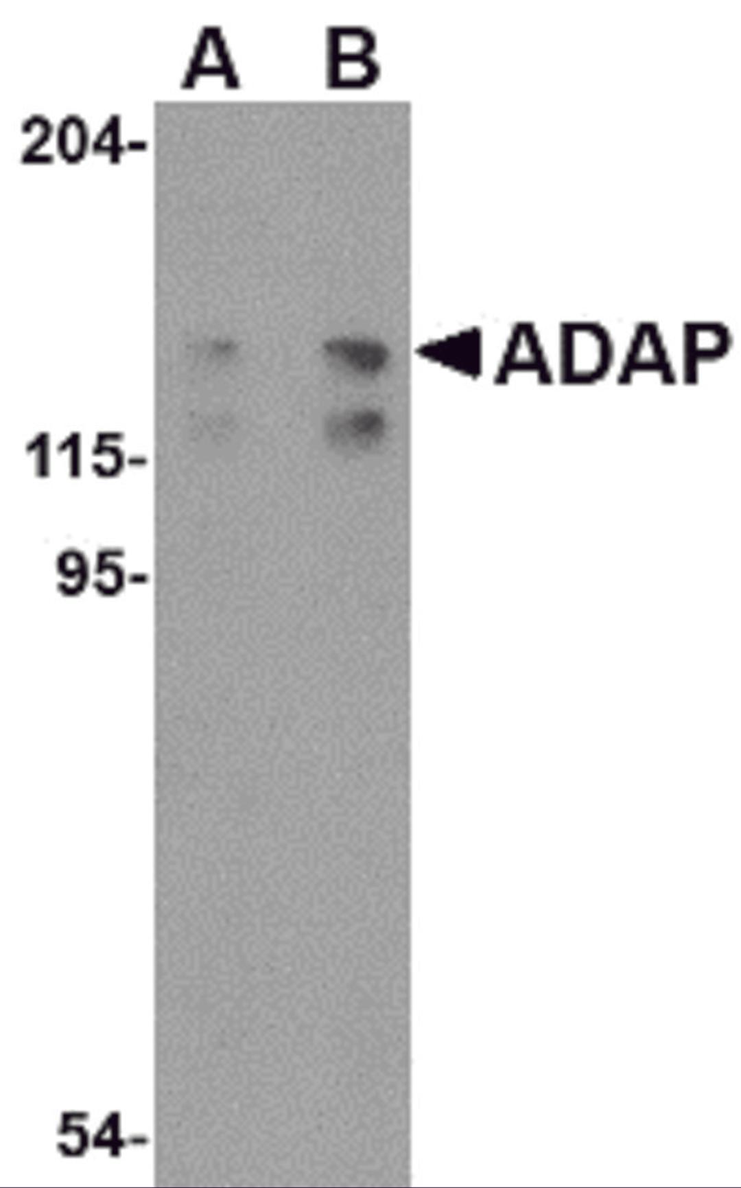 Western blot analysis of ADAP in K562 cell lysate with ADAP antibody at (A) 0.5 and (B) 1 &#956;g/mL.