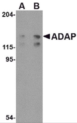 Western blot analysis of ADAP in K562 cell lysate with ADAP antibody at (A) 0.5 and (B) 1 μg/mL.