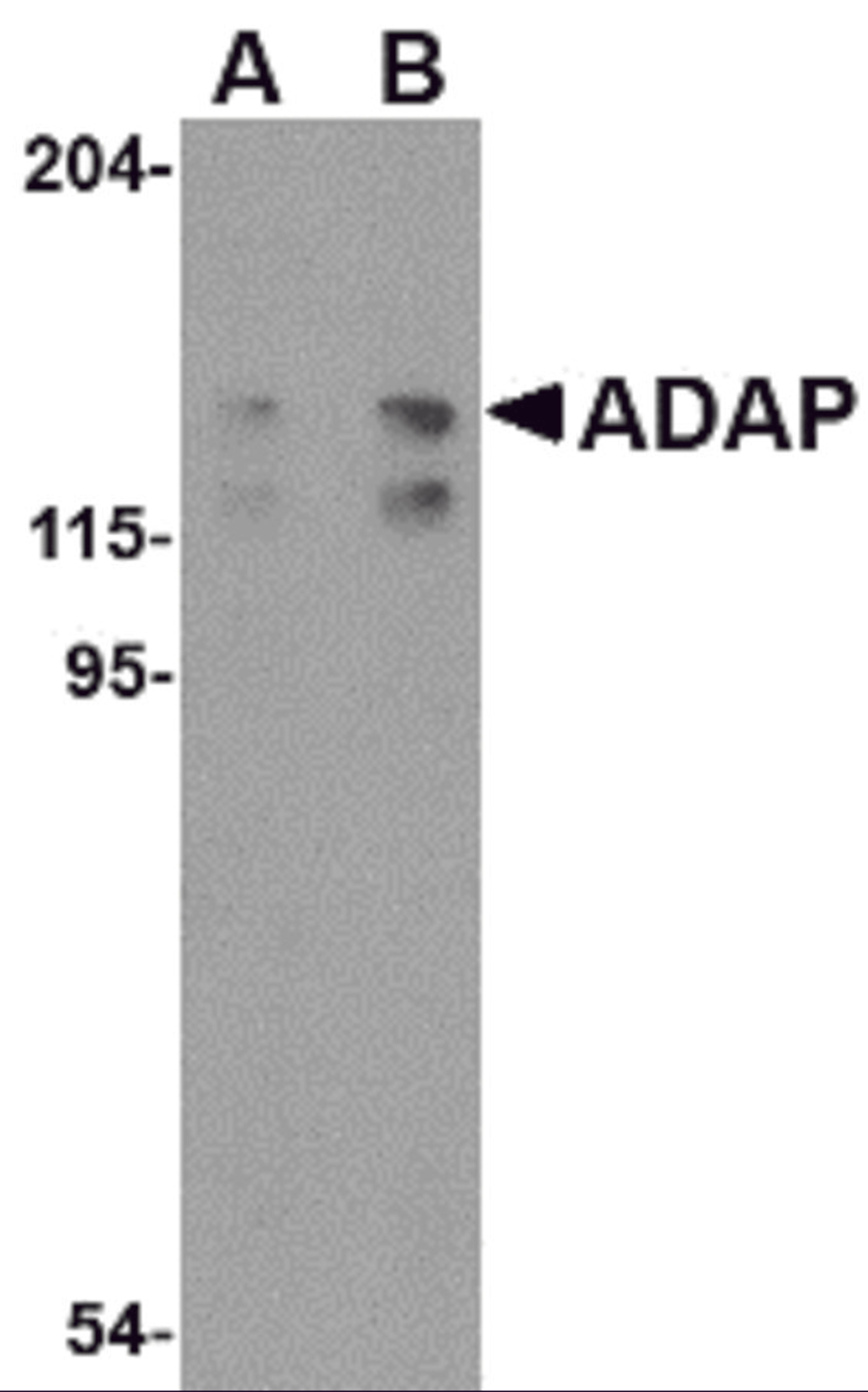 Western blot analysis of ADAP in K562 cell lysate with ADAP antibody at (A) 0.5 and (B) 1 μg/mL.