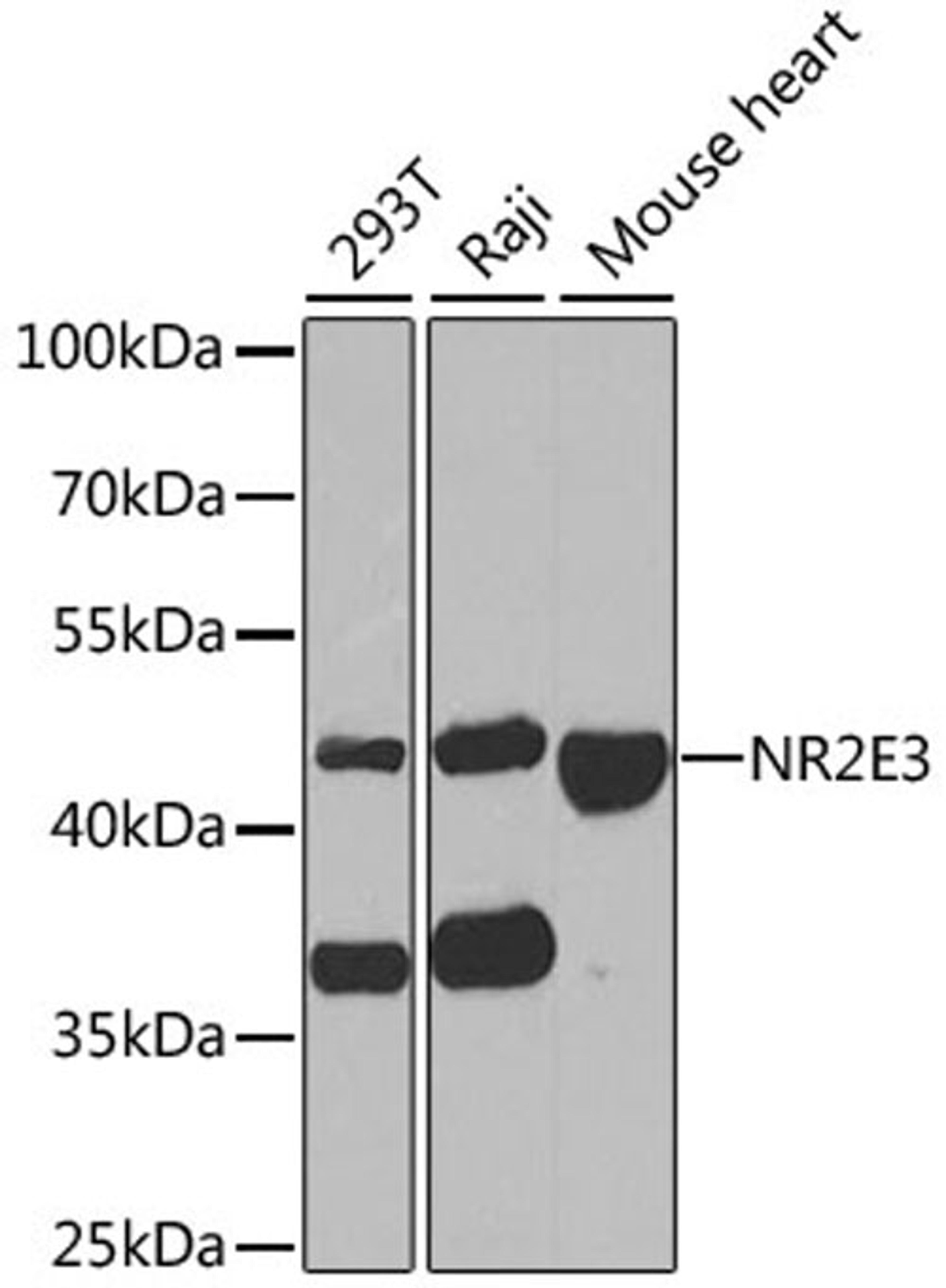 Western blot - NR2E3 antibody (A6234)