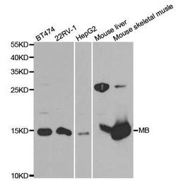 Western blot analysis of extracts of various cell lines using MB antibody