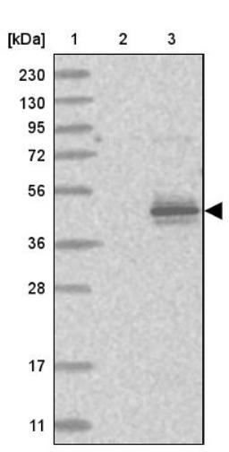 Western Blot: TCTE1 Antibody [NBP1-85322] - Lane 1: Marker [kDa] 230, 130, 95, 72, 56, 36, 28, 17, 11<br/>Lane 2: Human cell line RT-4<br/>Lane 3: Human cell line U-251MG sp