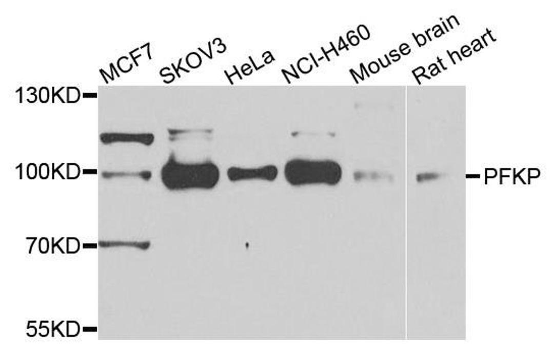 Western blot analysis of extracts of various cells using PFKP antibody