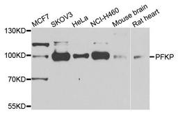 Western blot analysis of extracts of various cells using PFKP antibody