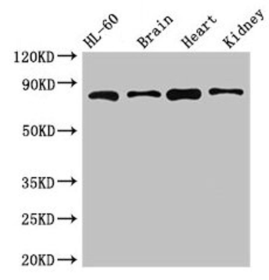 Western Blot. Positive WB detected in: HL60 whole cell lysate, Mouse brain tissue, Mouse heart tissue, Mouse kidney tissue. All lanes: ABCB9 antibody at 5µg/ml. Secondary. Goat polyclonal to rabbit IgG at 1/50000 dilution. Predicted band size: 85, 80, 67, 76, 78 kDa. Observed band size: 85 kDa