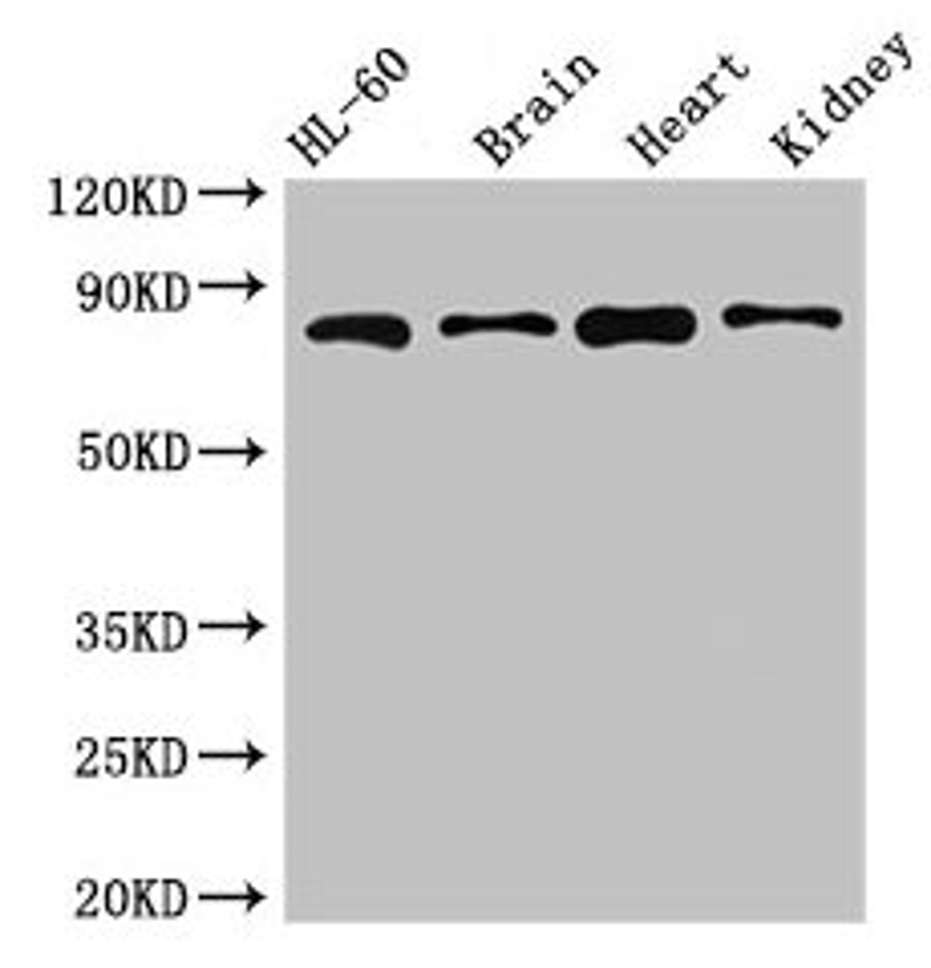 Western Blot. Positive WB detected in: HL60 whole cell lysate, Mouse brain tissue, Mouse heart tissue, Mouse kidney tissue. All lanes: ABCB9 antibody at 5µg/ml. Secondary. Goat polyclonal to rabbit IgG at 1/50000 dilution. Predicted band size: 85, 80, 67, 76, 78 kDa. Observed band size: 85 kDa