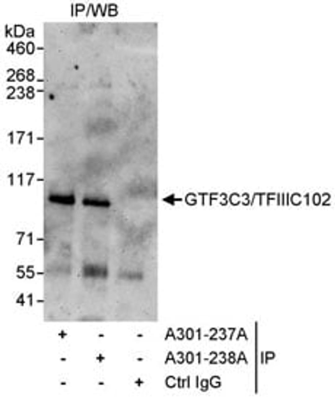 Detection of human GTF3C3/TFIIIC102 by western blot of immunoprecipitates.