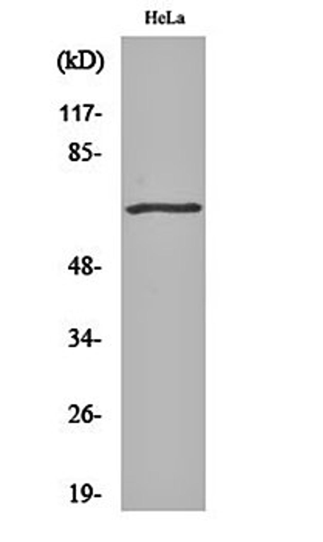 Western blot analysis of Hela cell lysates using GRK 5 antibody