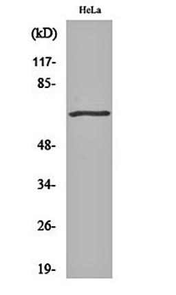 Western blot analysis of Hela cell lysates using GRK 5 antibody