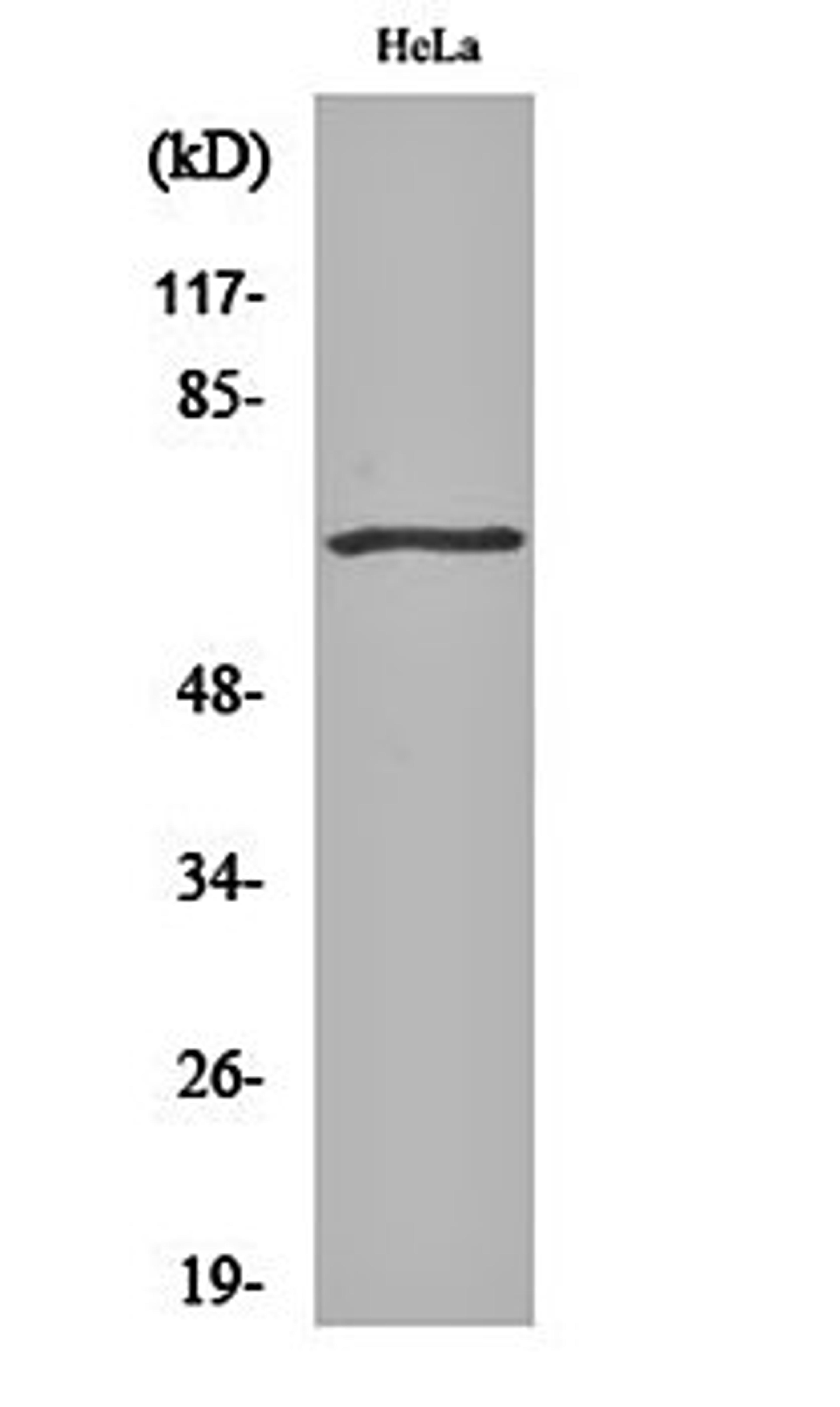 Western blot analysis of Hela cell lysates using GRK 5 antibody