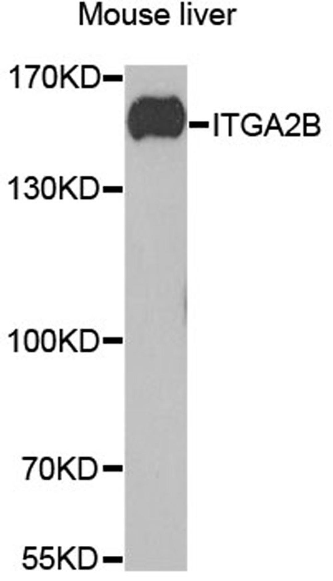 Western blot - ITGA2B antibody (A5680)