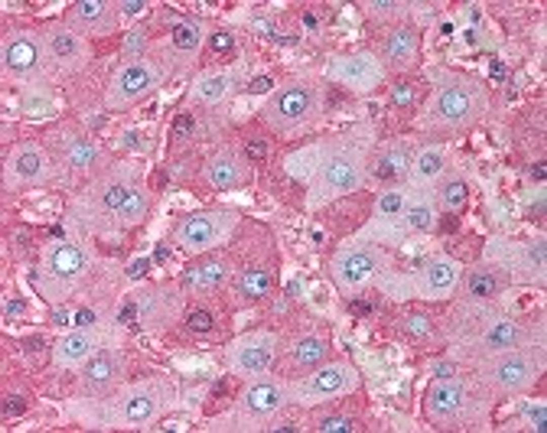 Immunohistochemistry staining of ALB in liver tissue using ALB monoclonal Antibody.