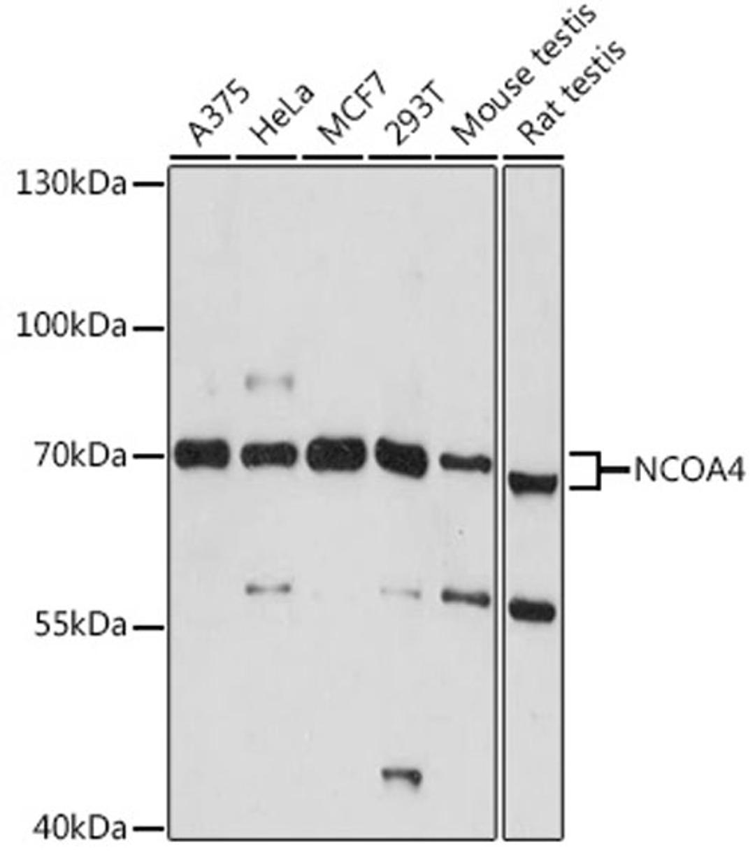 Western blot - NCOA4 antibody (A5695)