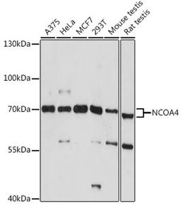 Western blot - NCOA4 antibody (A5695)