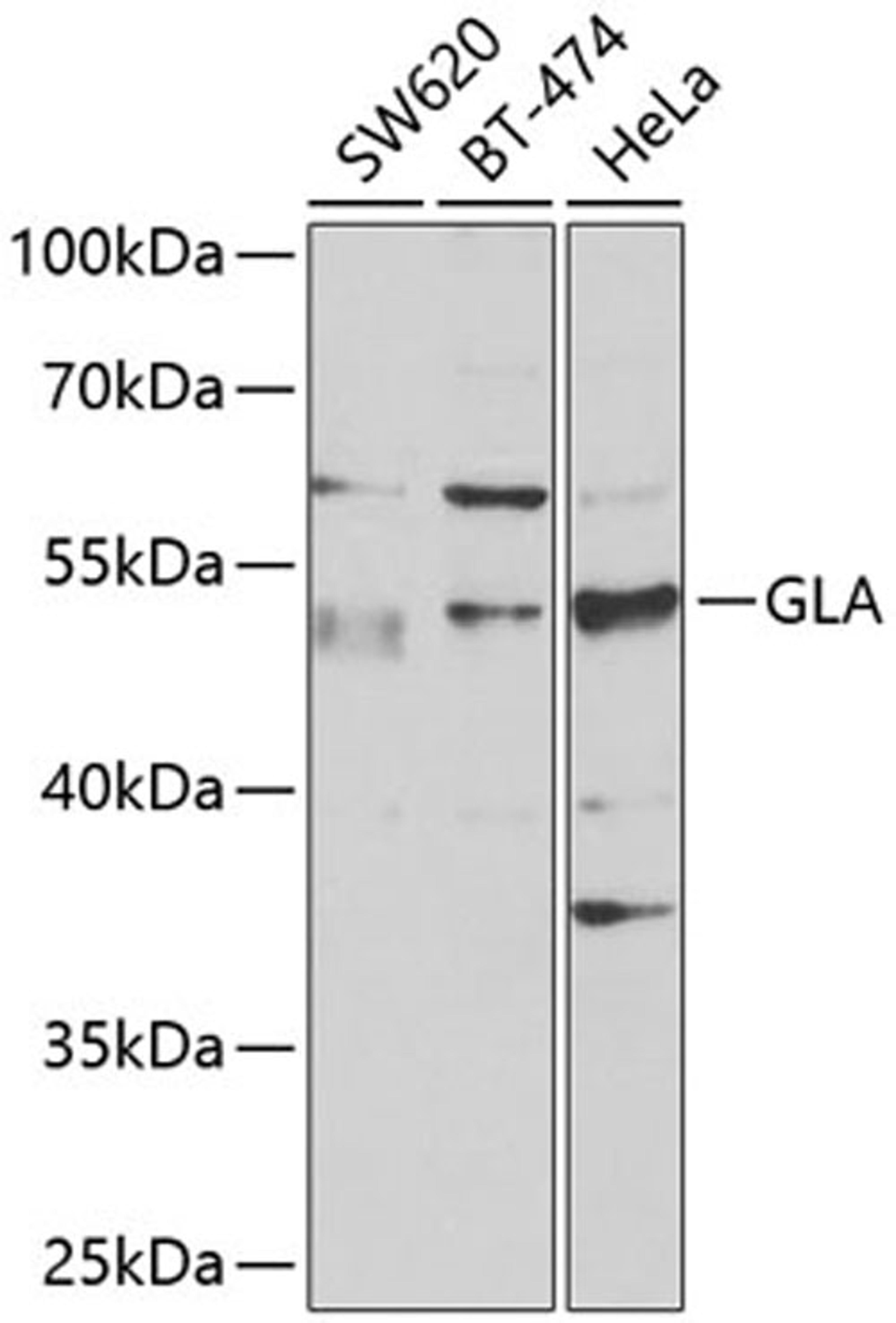 Western blot - GLA antibody (A1700)