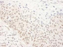 Detection of human DHX33 by immunohistochemistry.