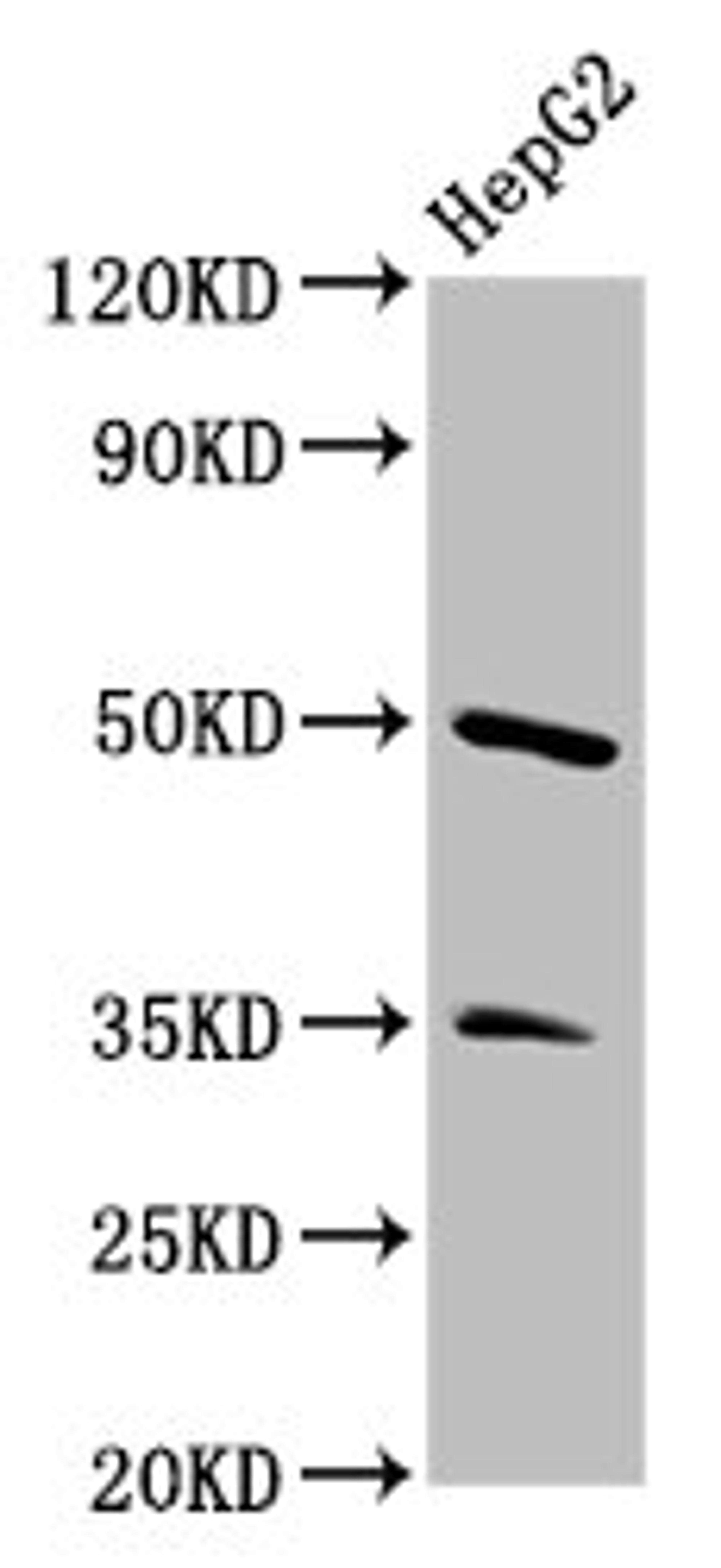 Western Blot. Positive WB detected in: HepG2 whole cell lysate. All lanes: PLA1A antibody at 3.4µg/ml. Secondary. Goat polyclonal to rabbit IgG at 1/50000 dilution. Predicted band size: 50, 41, 48, 32 kDa. Observed band size: 50 kDa