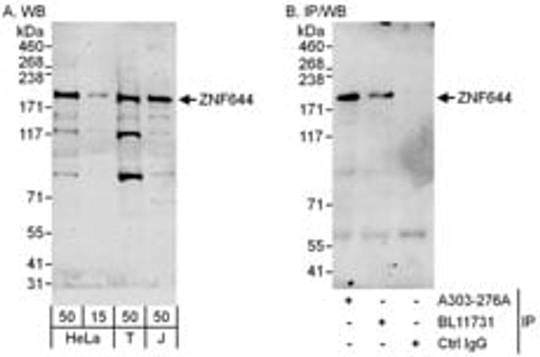 Detection of human ZNF644 by western blot and immunoprecipitation.