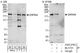 Detection of human ZNF644 by western blot and immunoprecipitation.