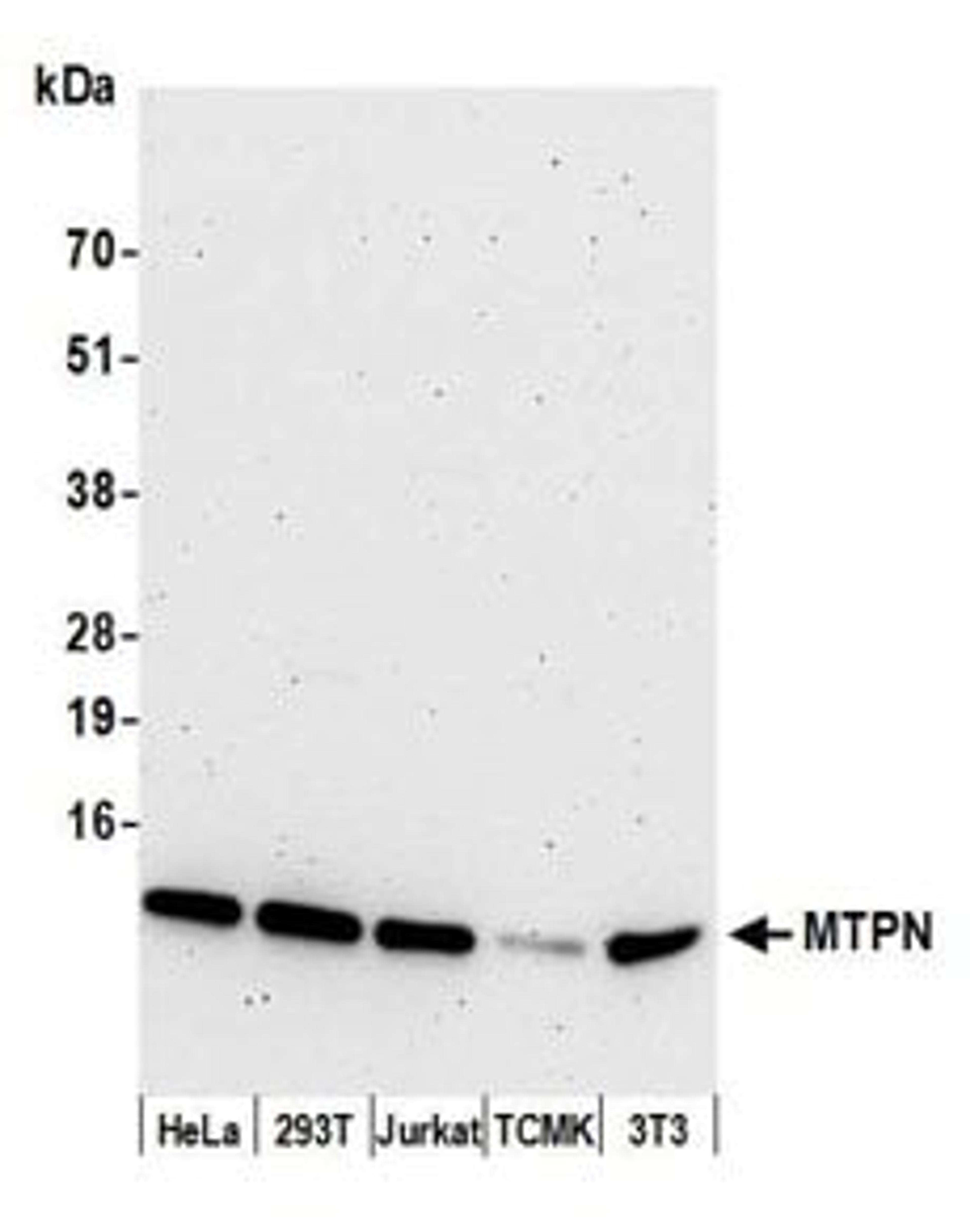 Detection of human and mouse MTPN by western blot.