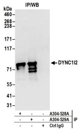 Detection of human DYNC1I2 by western blot of immunoprecipitates.