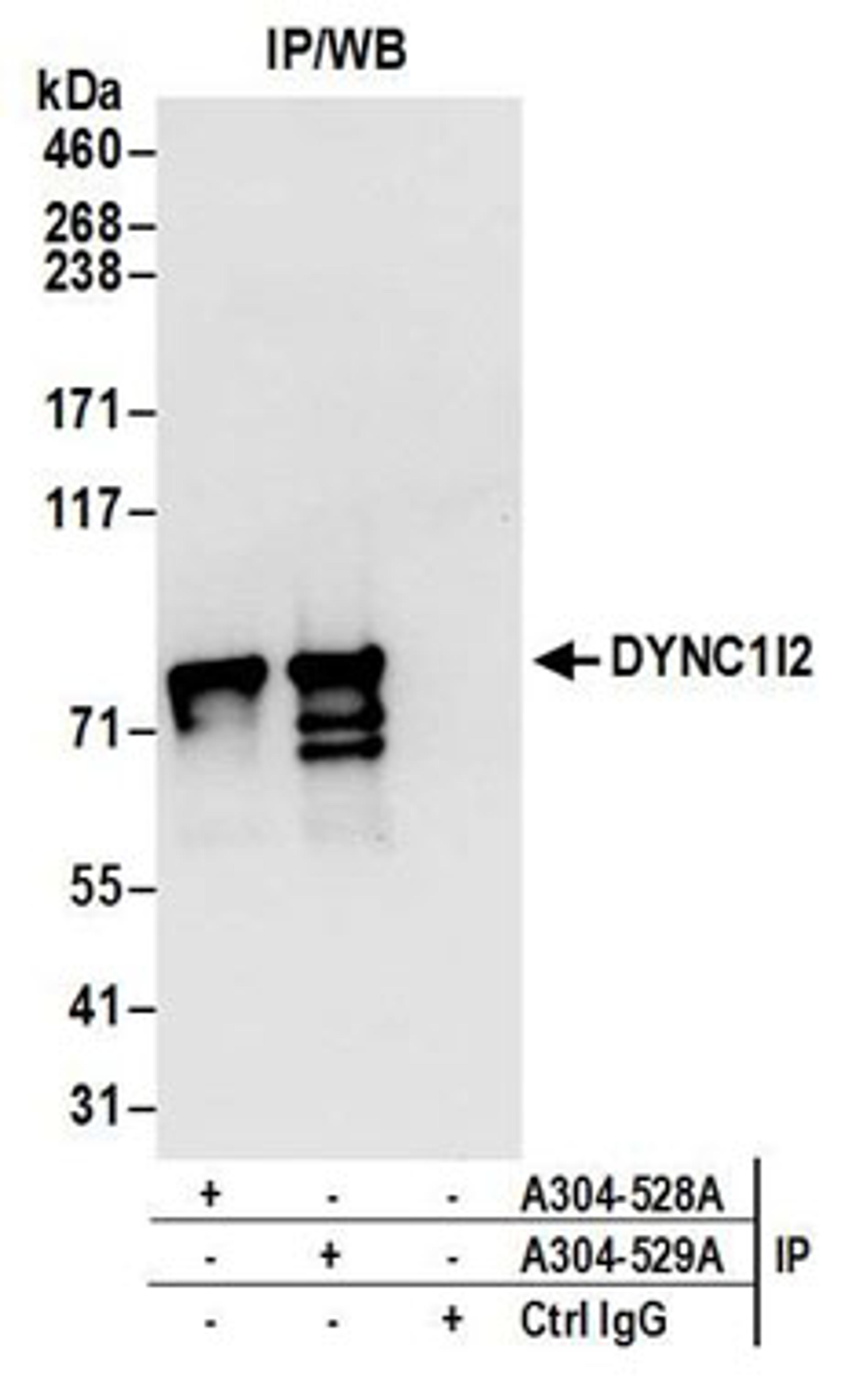 Detection of human DYNC1I2 by western blot of immunoprecipitates.