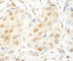 Detection of human HCA66 by immunohistochemistry.