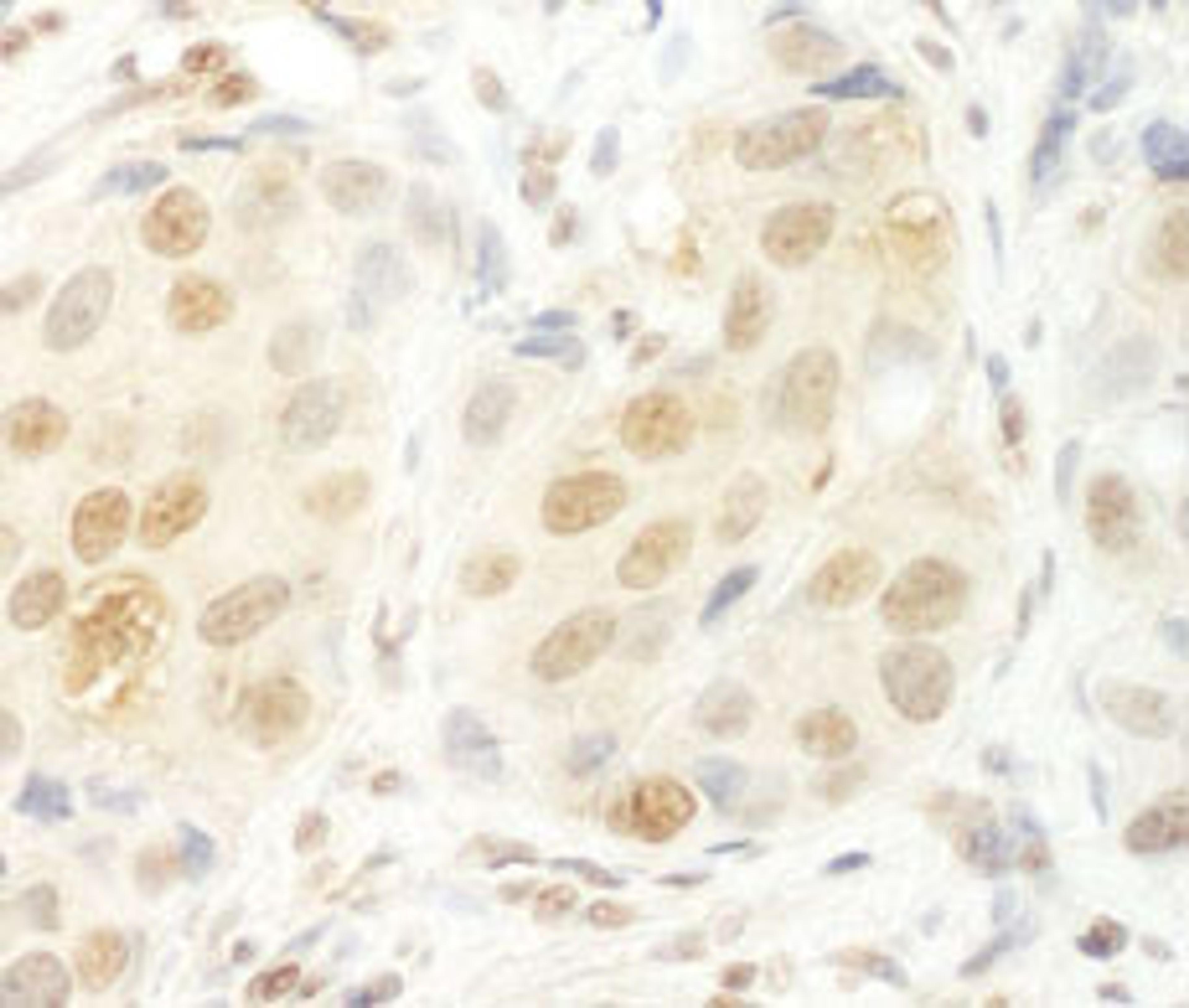 Detection of human HCA66 by immunohistochemistry.