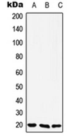 Western blot analysis of Jurkat (Lane 1), Raw264.7 (Lane 2), H9C2 (Lane 3) whole cell lysates using YAF2 antibody