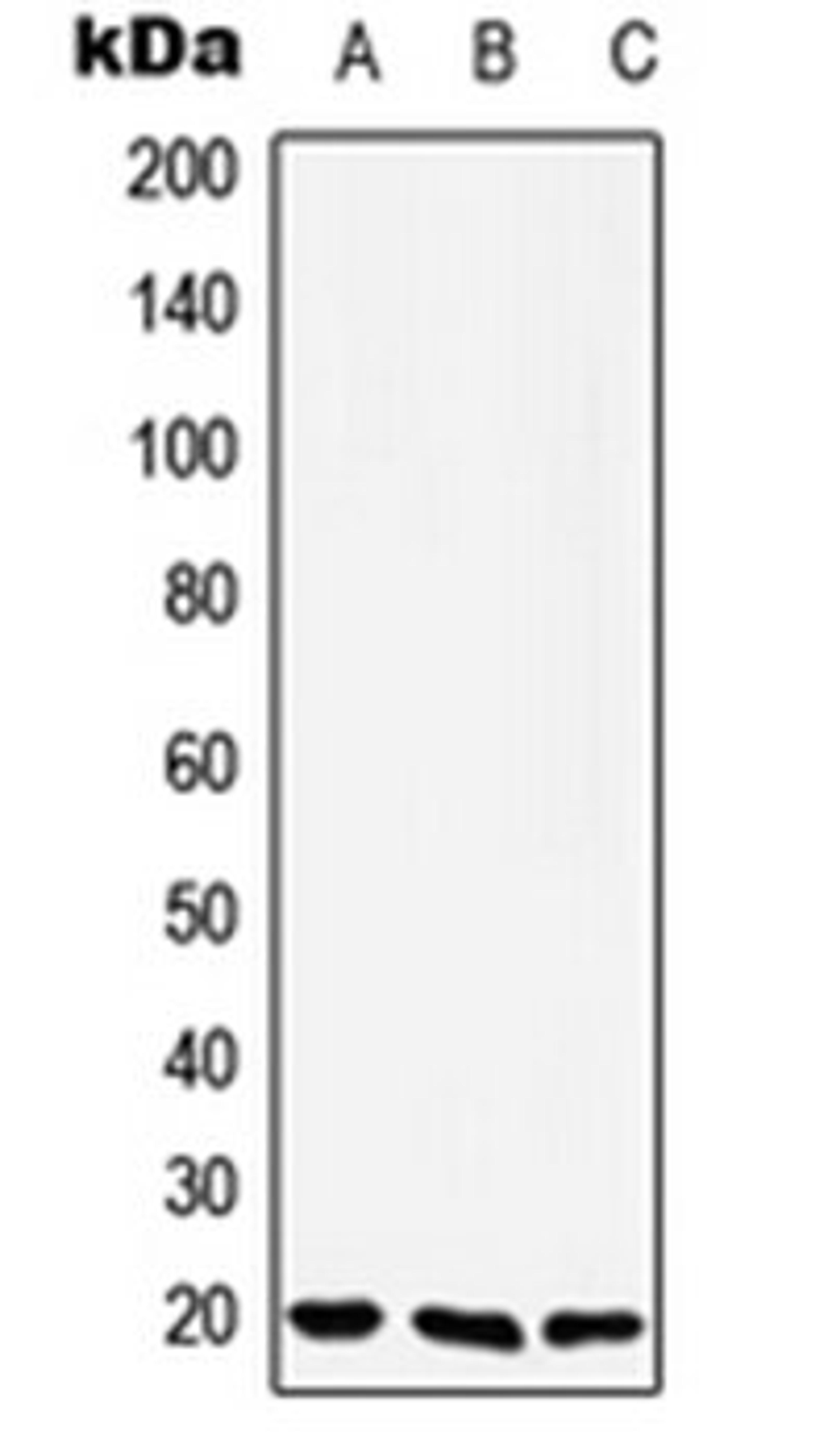 Western blot analysis of Jurkat (Lane 1), Raw264.7 (Lane 2), H9C2 (Lane 3) whole cell lysates using YAF2 antibody