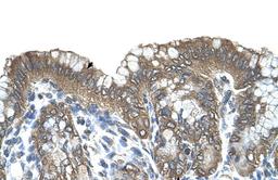 Antibody used in IHC on Human Stomach.