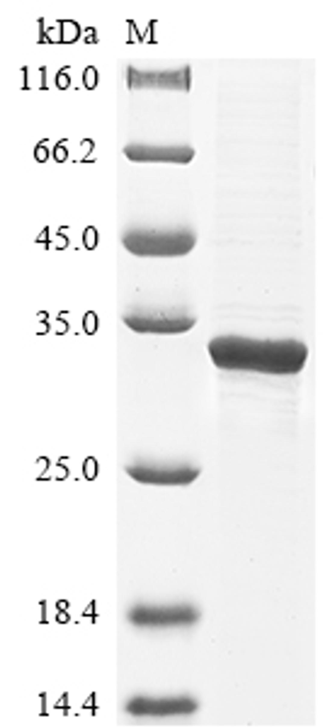 (Tris-Glycine gel) Discontinuous SDS-PAGE (reduced) with 5% enrichment gel and 15% separation gel.