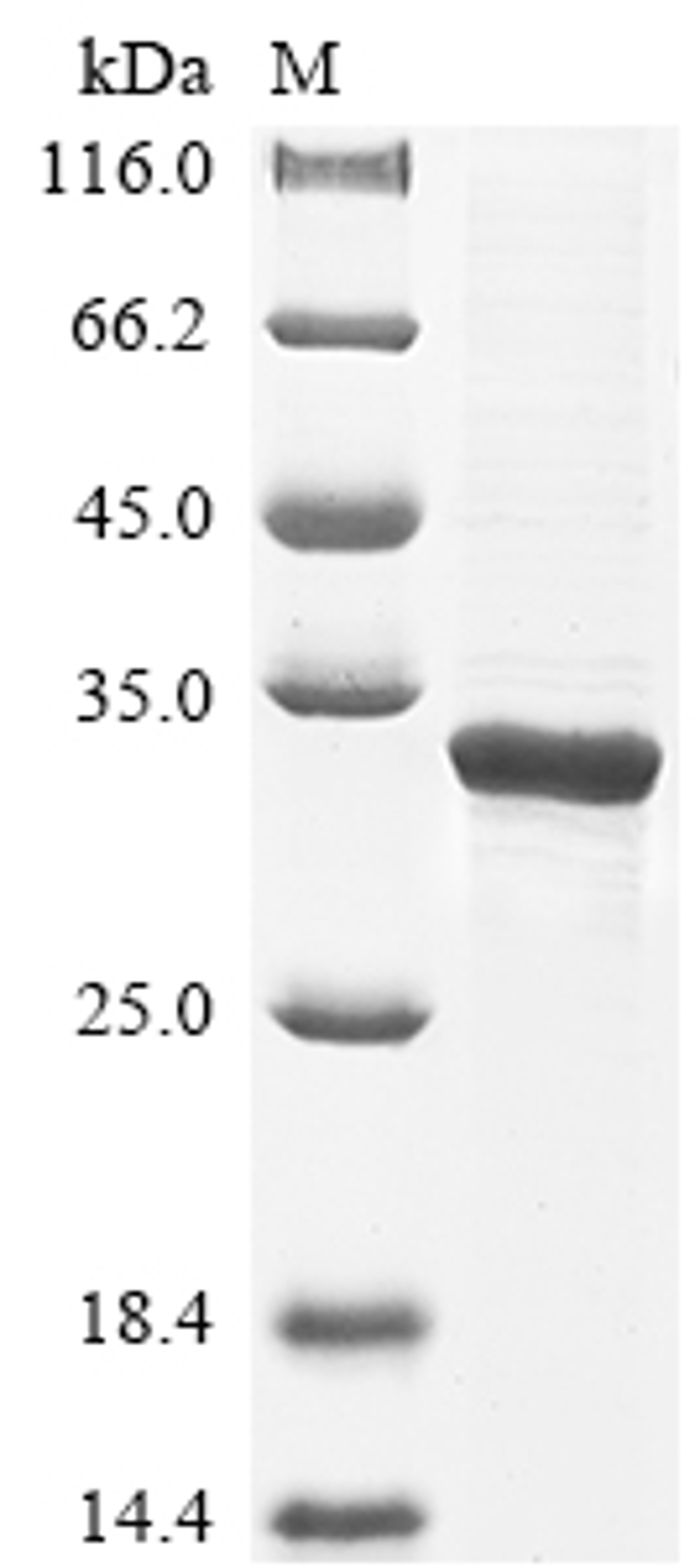 (Tris-Glycine gel) Discontinuous SDS-PAGE (reduced) with 5% enrichment gel and 15% separation gel.