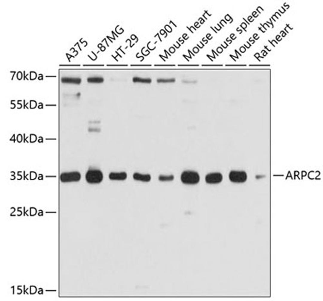 Western blot - ARPC2 antibody (A10791)