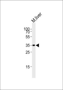 Western blot analysis of lysate from mouse liver tissue lysate, using Hmx2 Antibody at 1:1000.